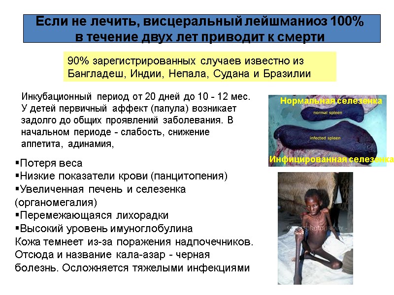 Если не лечить, висцеральный лейшманиоз 100%  в течение двух лет приводит к смерти